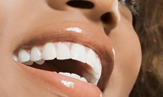 牙齿美白最快的方法 牙齿美白最快的方法